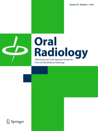 Diagnostic performance of artificial intelligence for facial fracture  detection: a systematic review